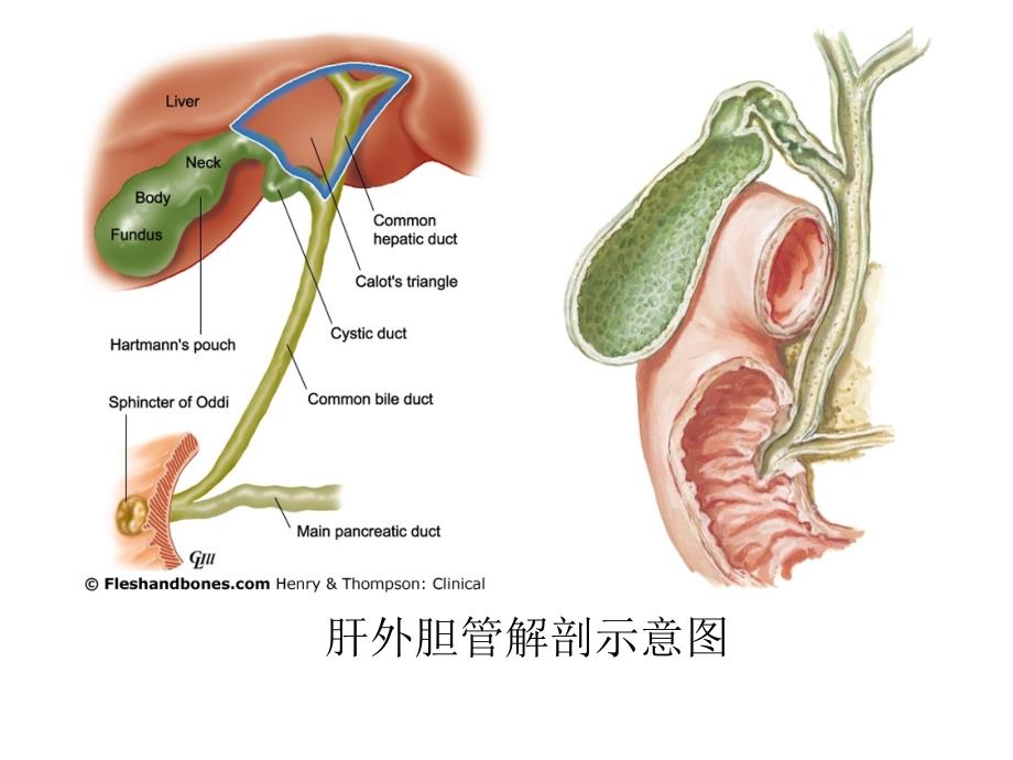 胆总管结石的微创处理PPT课件.ppt_第3页