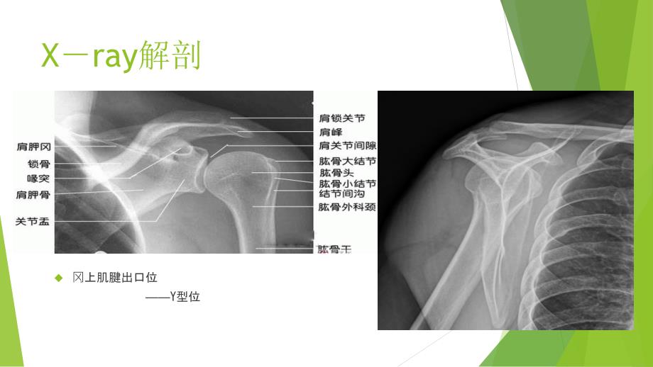 肩关节解剖及其损伤的MR诊断_第4页