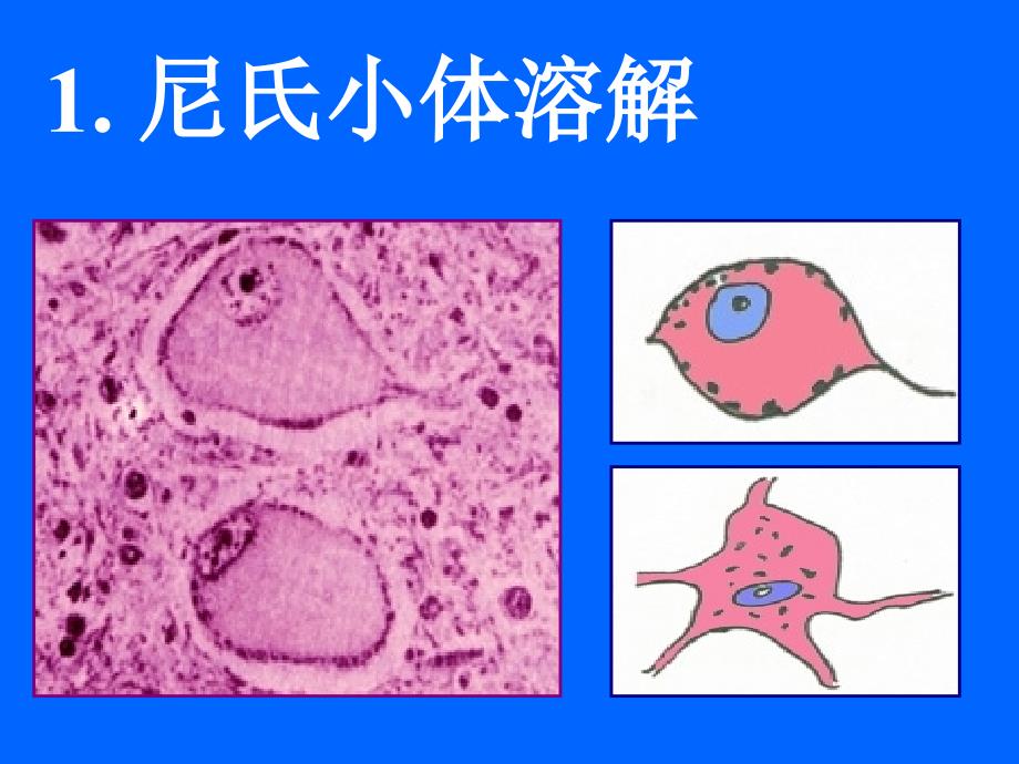 神经系统疾病-昆明医学院.ppt_第3页