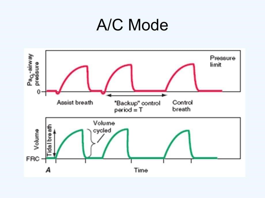 呼吸机常见模式及参数设置_第5页