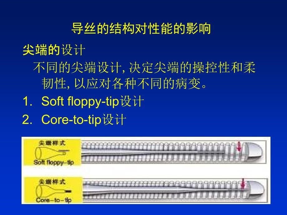 导丝分类及选择_第5页