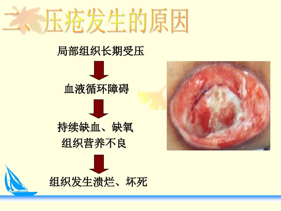 压疮预防及护理PPT_第3页