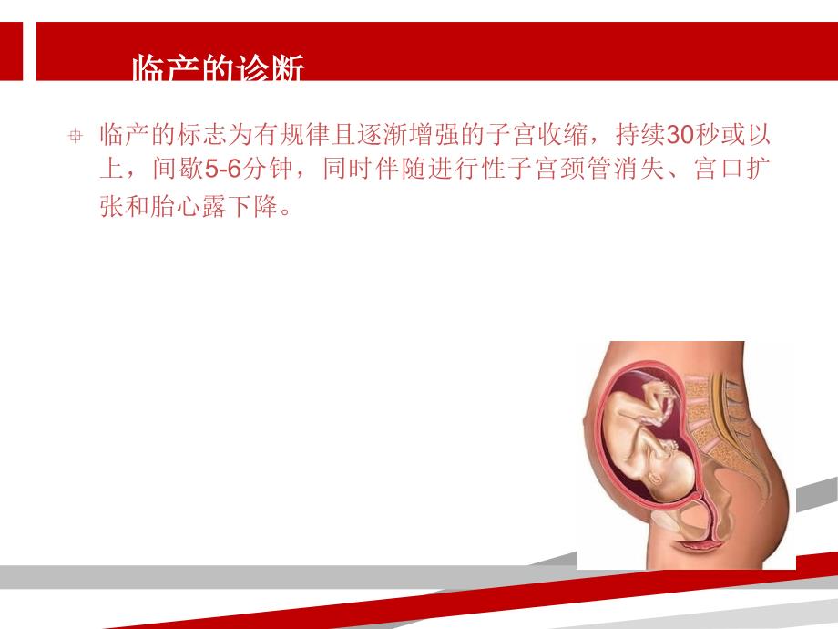 导乐分娩课件.ppt_第3页