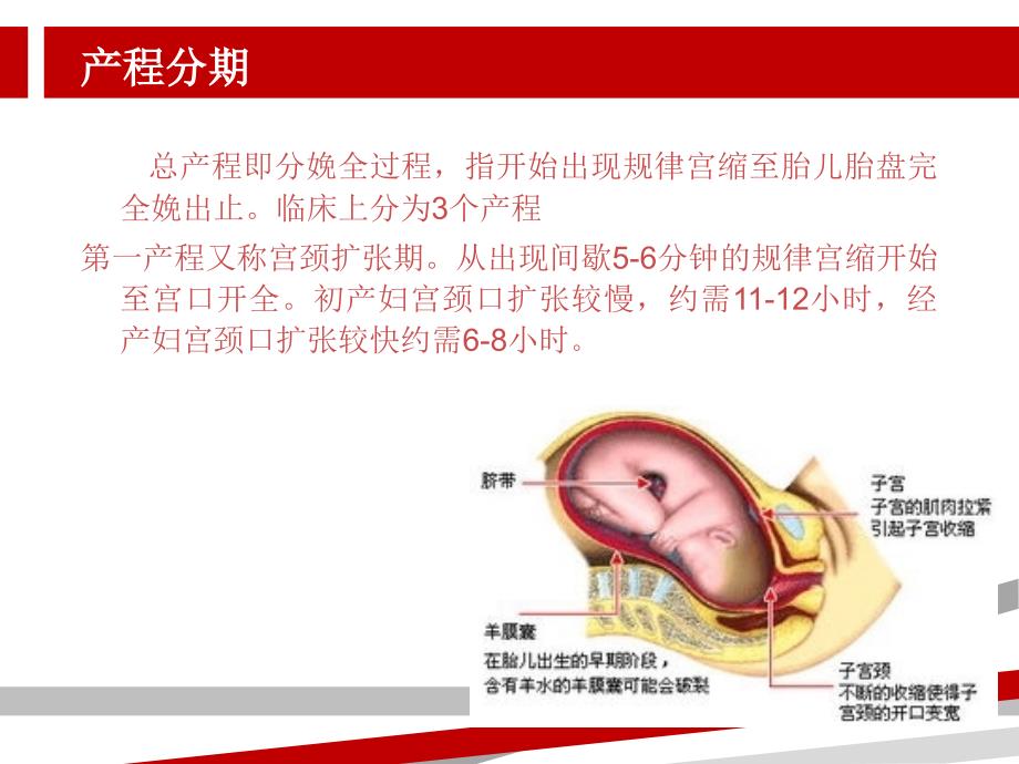 导乐分娩课件.ppt_第4页