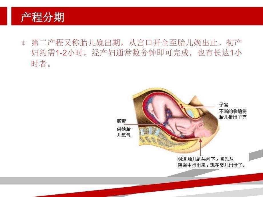 导乐分娩课件.ppt_第5页