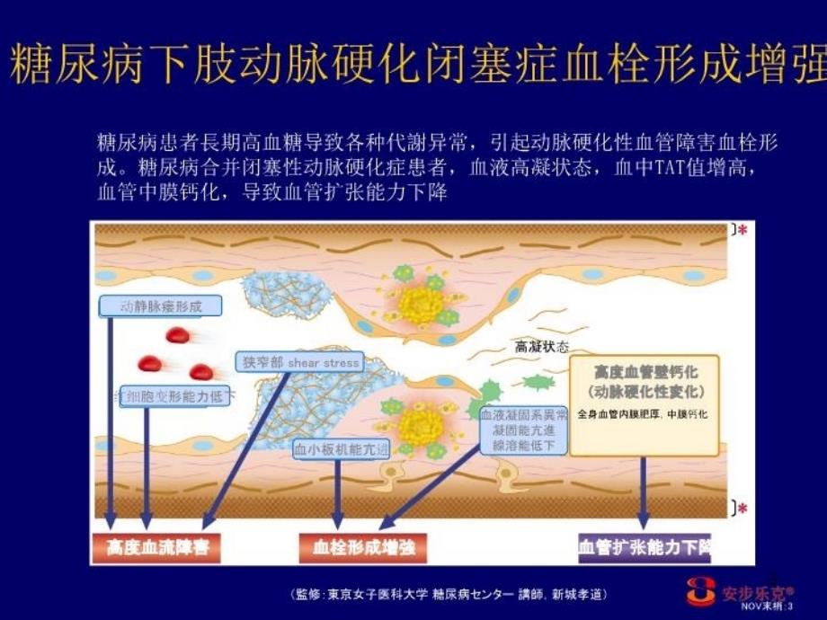 最新安步乐克对糖尿病下肢血管病变的治疗作用PPT课件_第3页