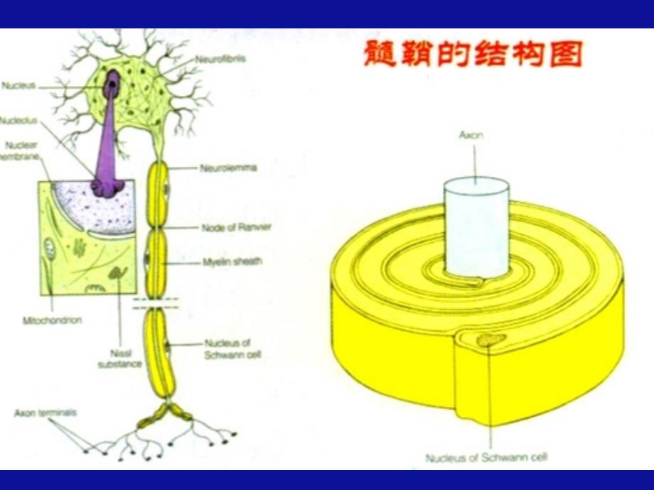 脱髓鞘幻灯医大课件_第3页