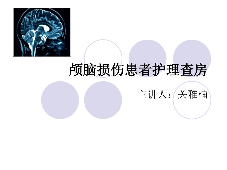 脑震荡.ppt_第1页