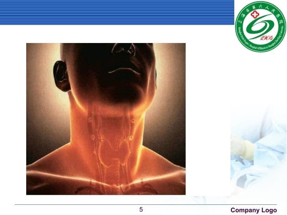 内科学甲状腺功能亢进症ppt课件_第5页