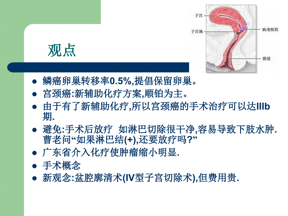 宫颈癌治疗新进展_第2页