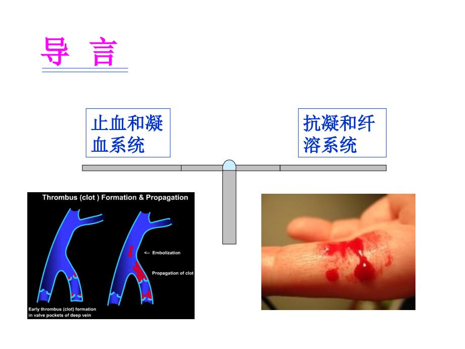 实验诊断学：出血、血栓与止血检测_第4页