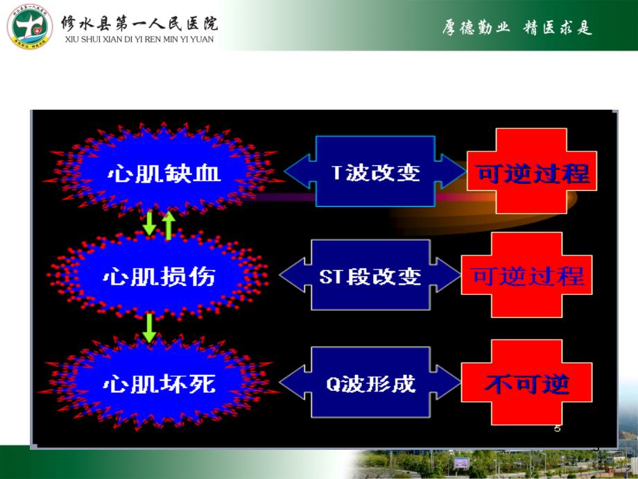 急性心肌梗死及常见心电图识别ppt课件_第3页