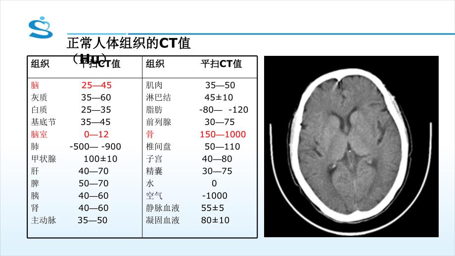 精品头颅CT基本知识及神经外科常见疾病CT读片ppt_第3页