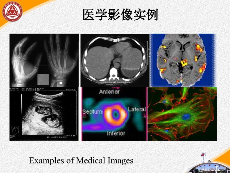 医学影像处理概述与发展历史_第2页