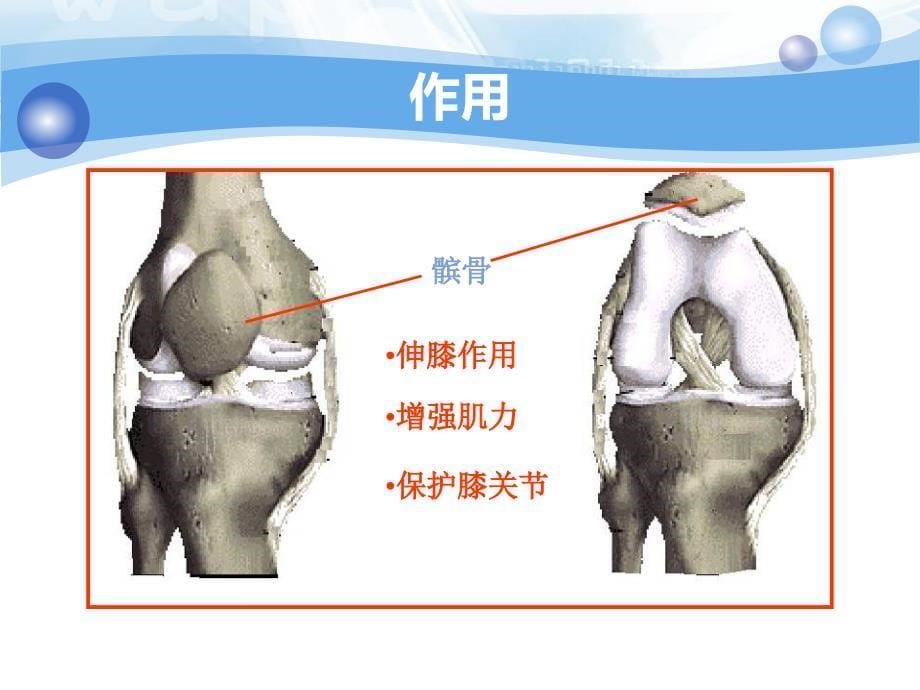 髌骨骨折护理查房_第5页