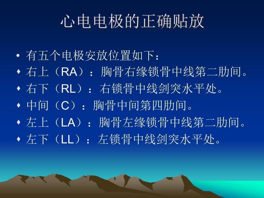 心电监护仪器的使用ppt课件_第5页