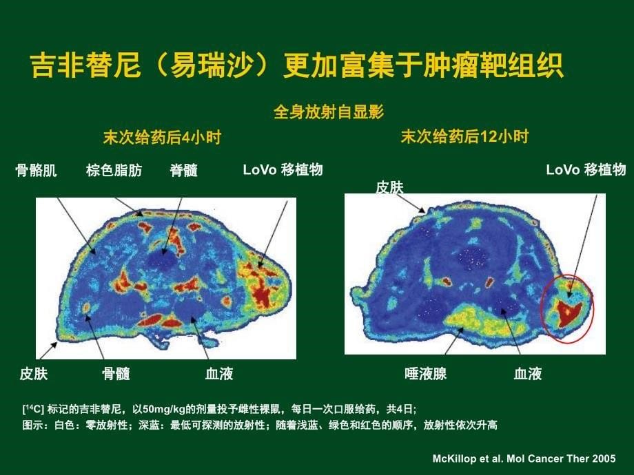 吉非替尼的组织分布特点_第5页