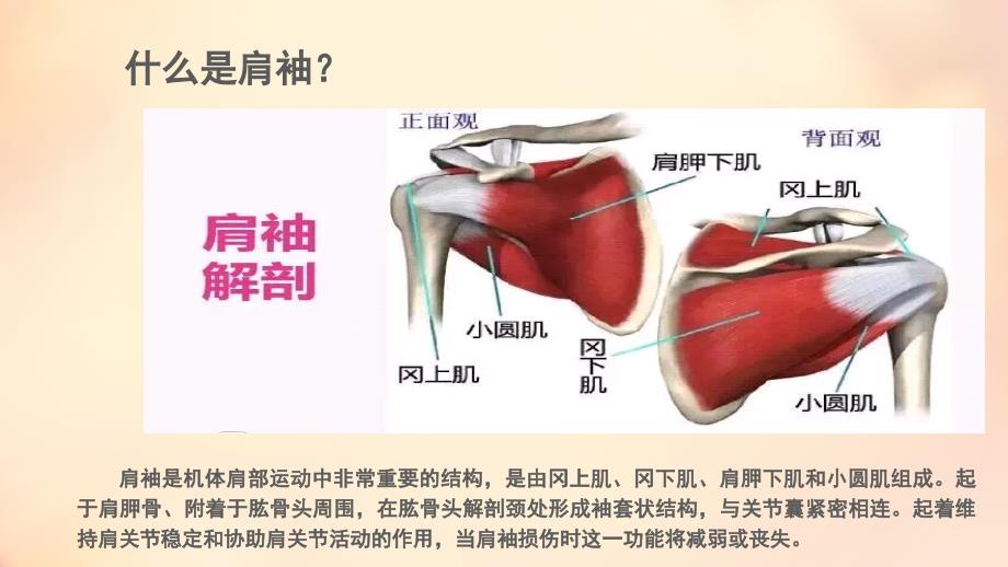 肩袖损伤护理疾病查房.ppt_第3页