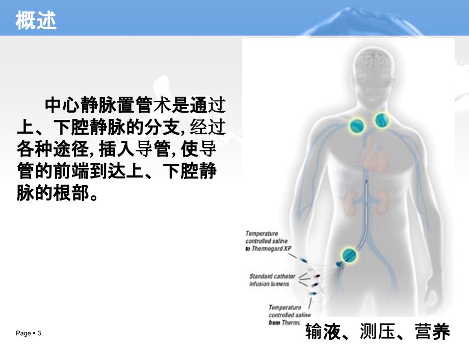 中心静脉置管术的护理课件_第3页