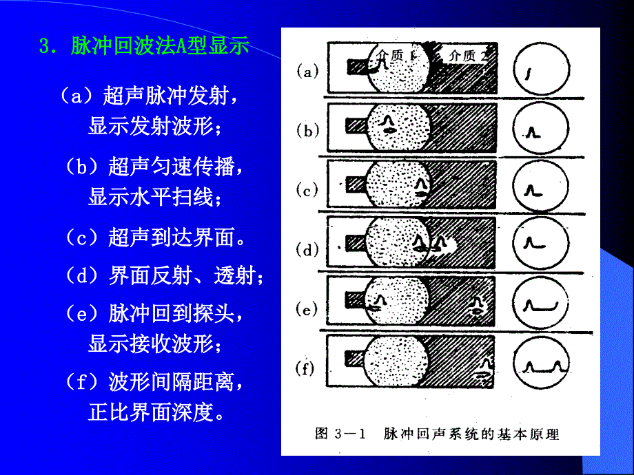 医学超声成像的基本原理_第2页