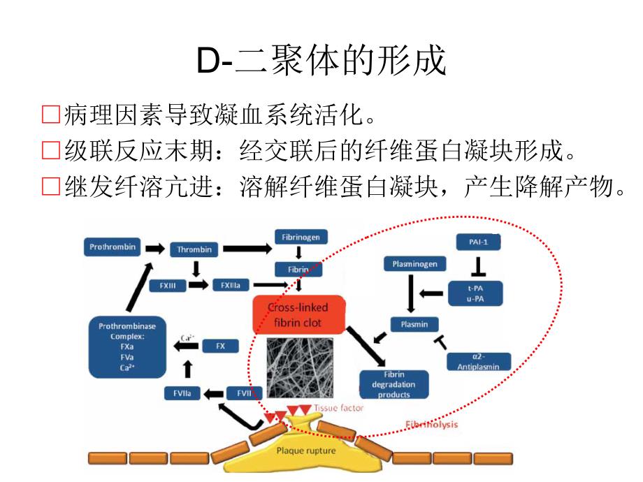 .01.13D二聚体检测的临床实践上海_第4页