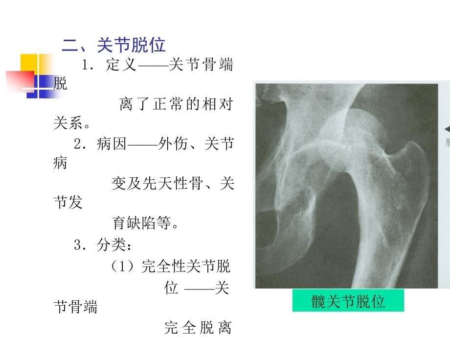 骨骼常见病的X线诊断_第5页