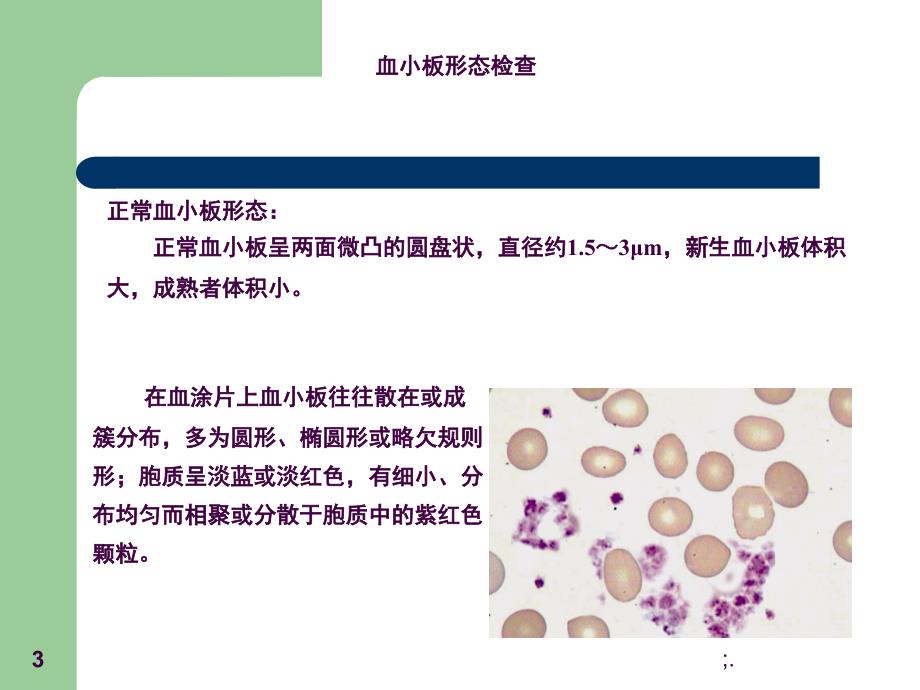 四血小板计数ppt课件_第3页