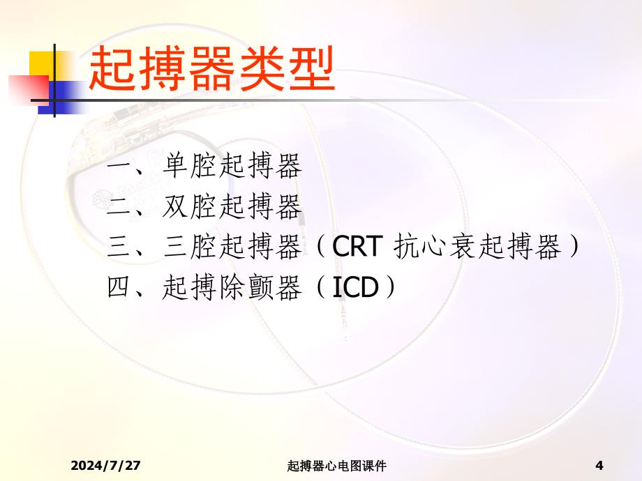 起搏器心电图课件_第4页