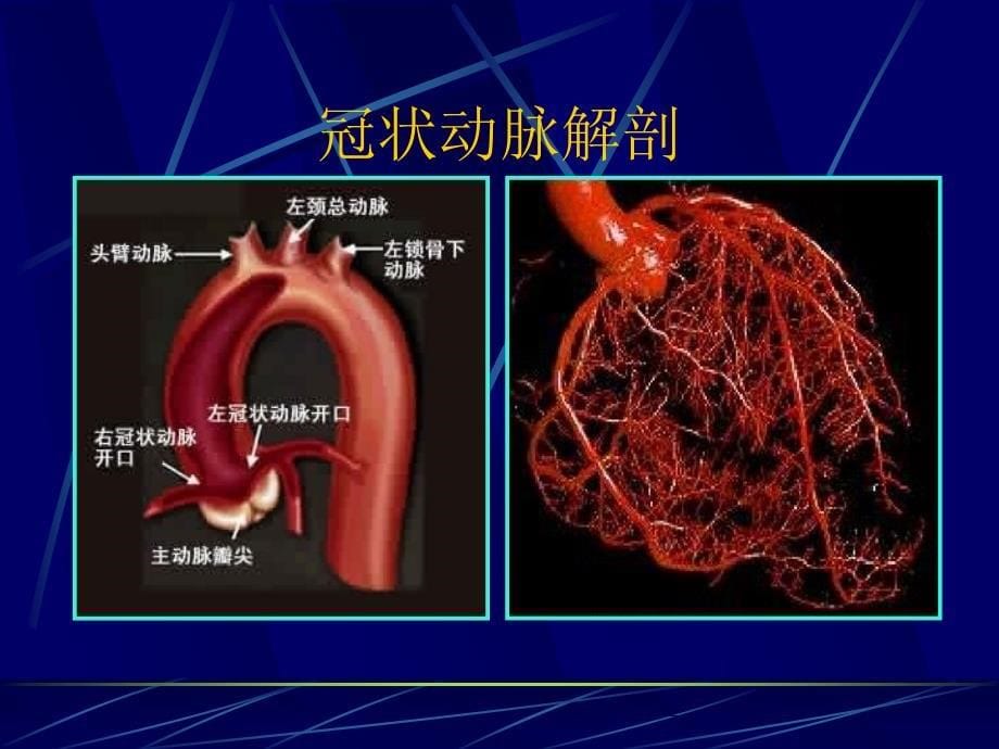 博士冠心病介入治疗课件_第5页