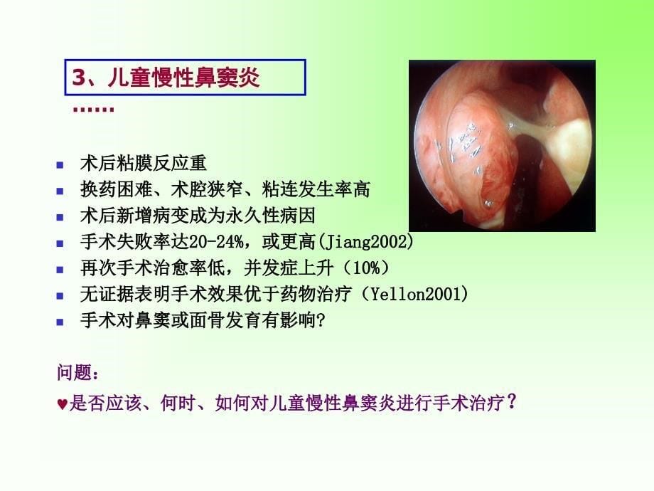 儿童鼻窦炎ppt课件_第5页