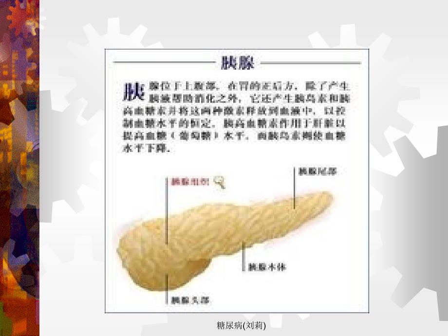 糖尿病刘莉课件_第4页