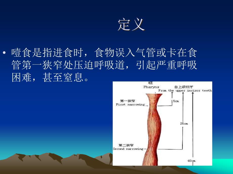 精神病人噎食护理_第2页