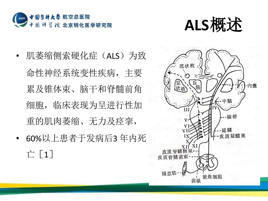 肌萎缩侧索硬化临床诊断进展_第5页