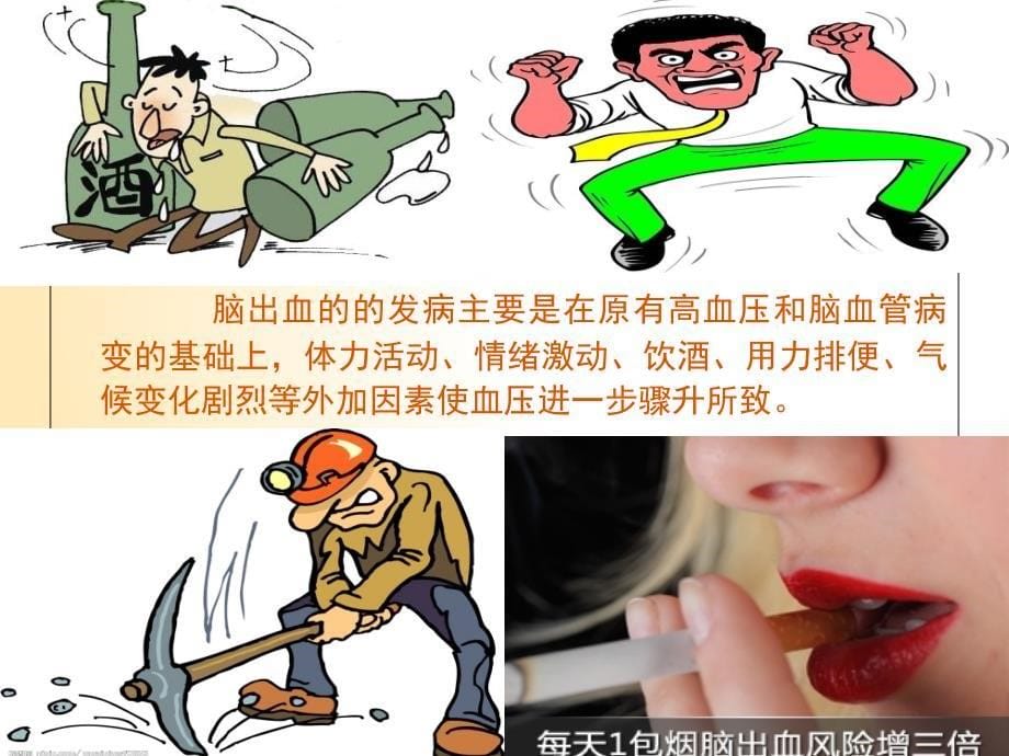 脑出血病人后遗症期的康复护理(最新定稿)ppt课件_第5页