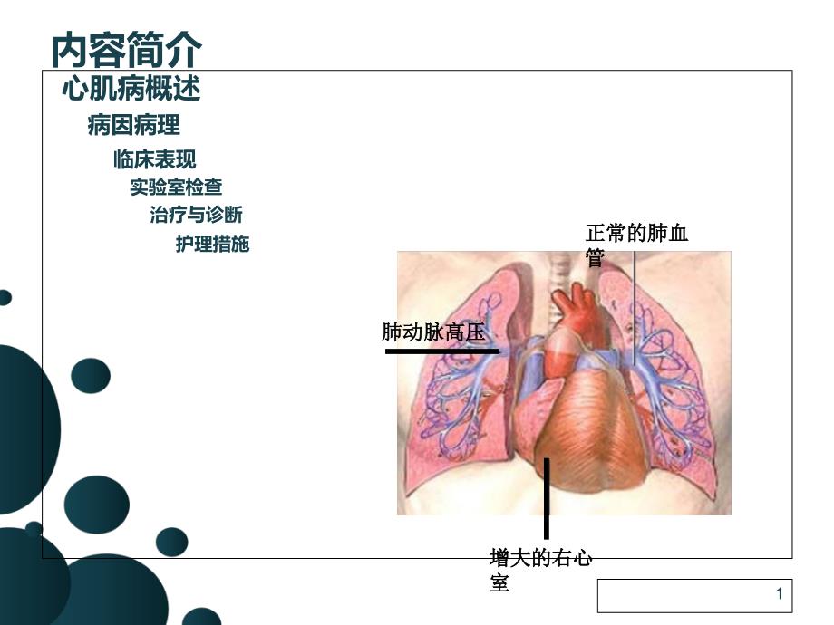 扩张性心肌病的护理查房张性1PPT文档_第1页