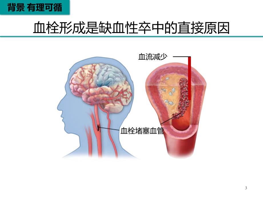 脑梗死再灌注治疗ppt课件_第3页