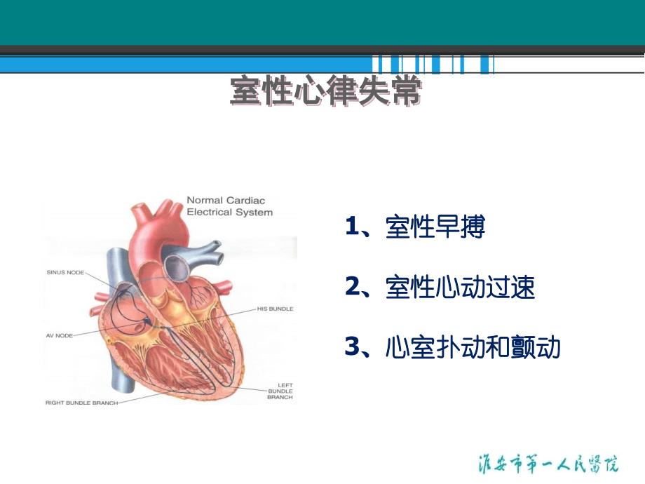 室性心律失常的药物治疗进展课件_第2页