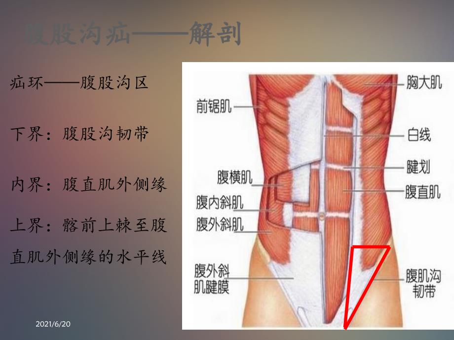 腹股沟疝 课件_第2页