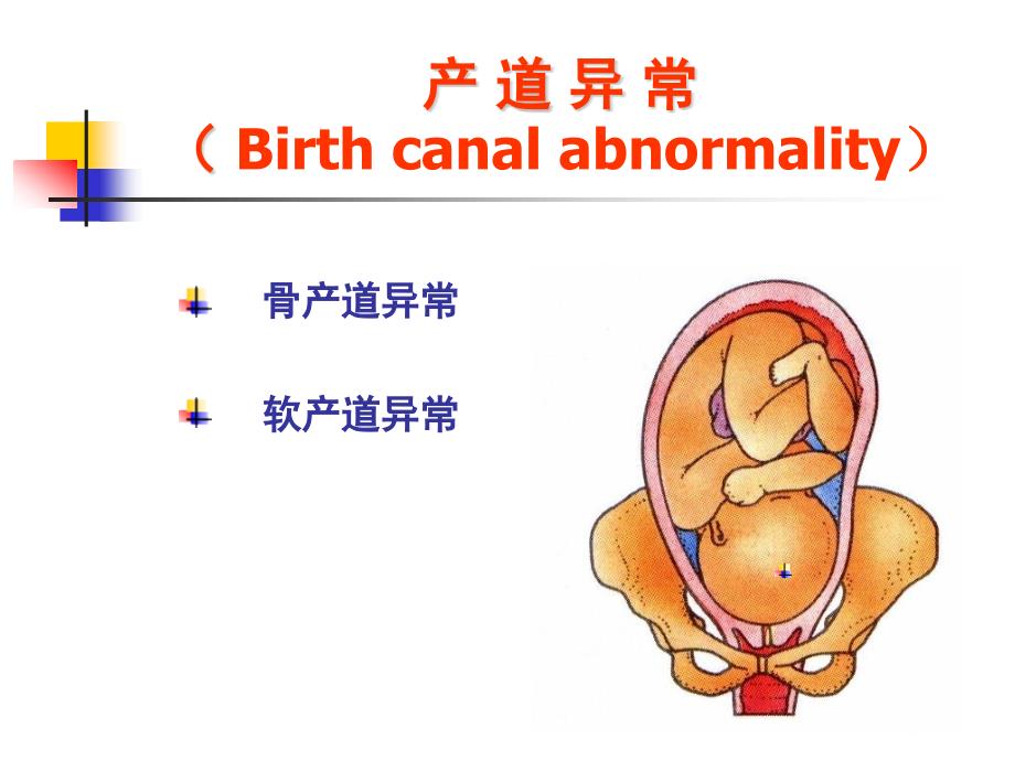 产道异常的分类和临床表现_第2页