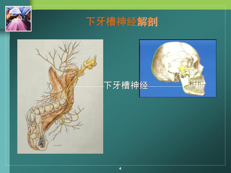 下牙槽神经阻滞麻醉.ppt_第4页