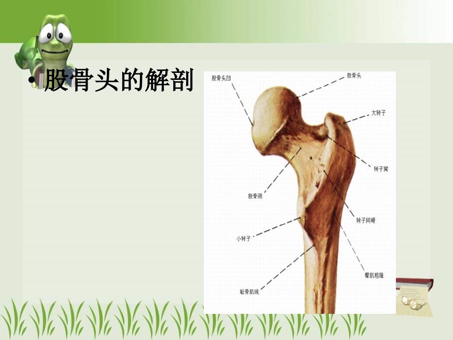 股骨粗隆间骨折课件_第4页