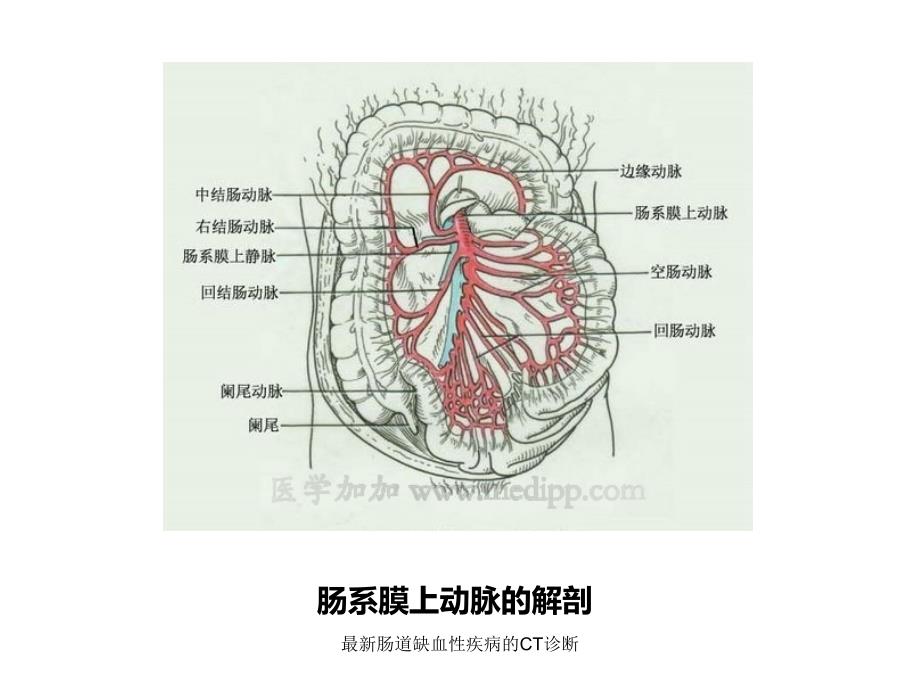 肠道缺血性疾病的CT诊断_第3页