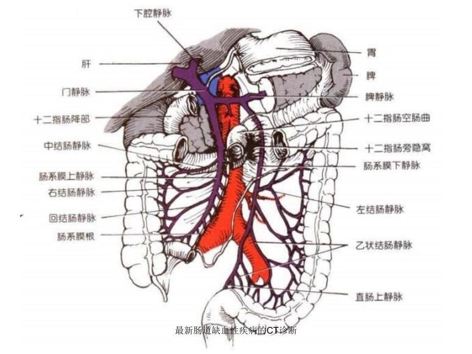 肠道缺血性疾病的CT诊断_第5页