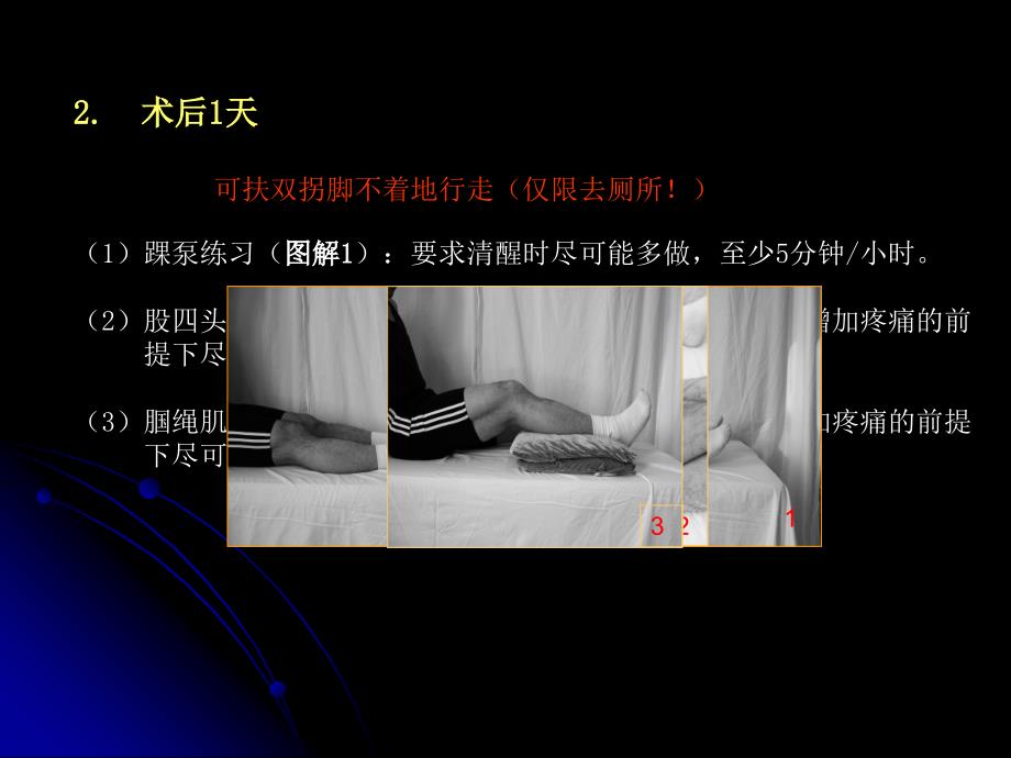 后交叉韧带重建康复治疗.ppt_第4页