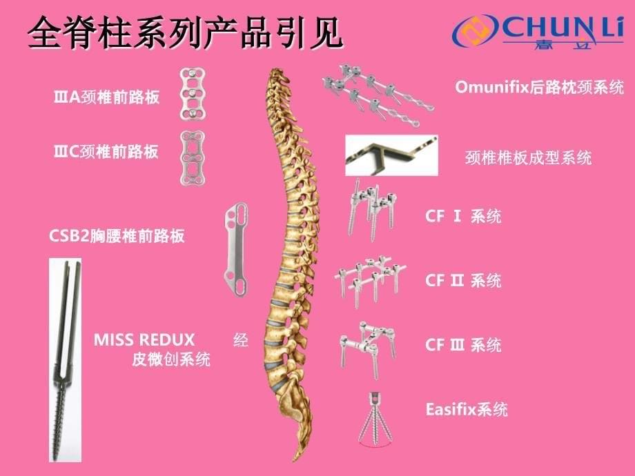 全脊柱系统产品介绍王振伟ppt课件_第5页