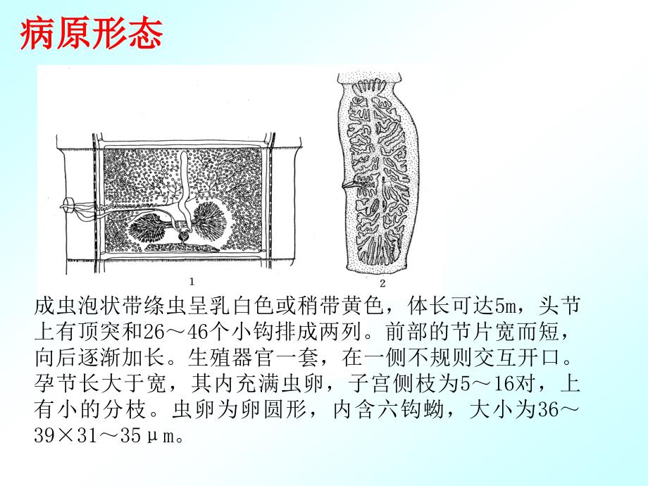 302细颈囊尾蚴_第3页