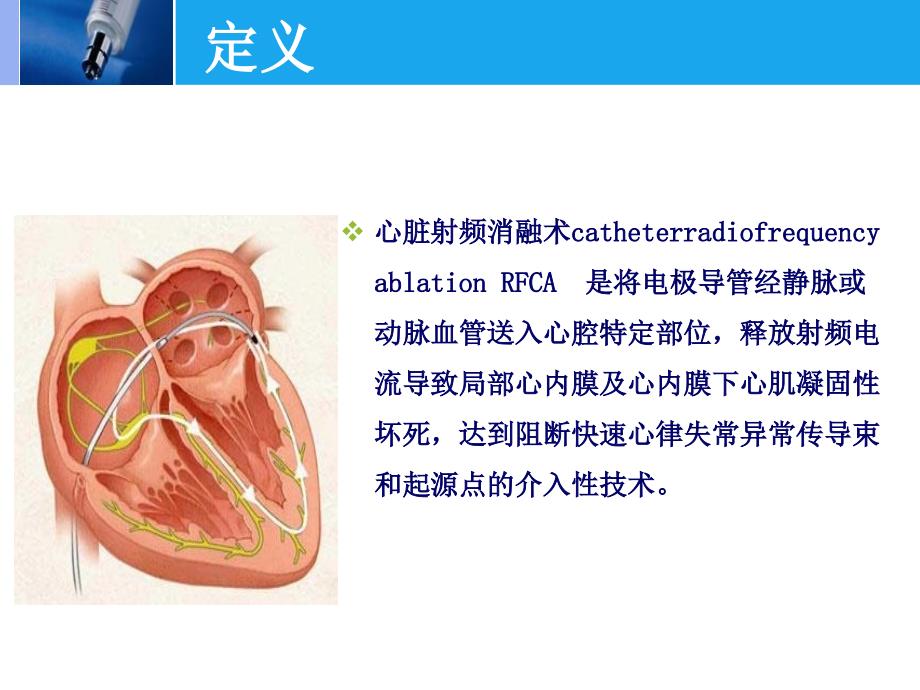 射频消融术的护理_第3页