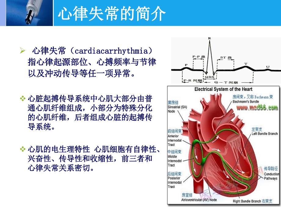 射频消融术的护理_第4页