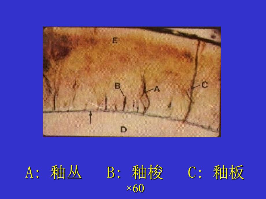 牙本质牙髓牙骨质课件!!!_第1页
