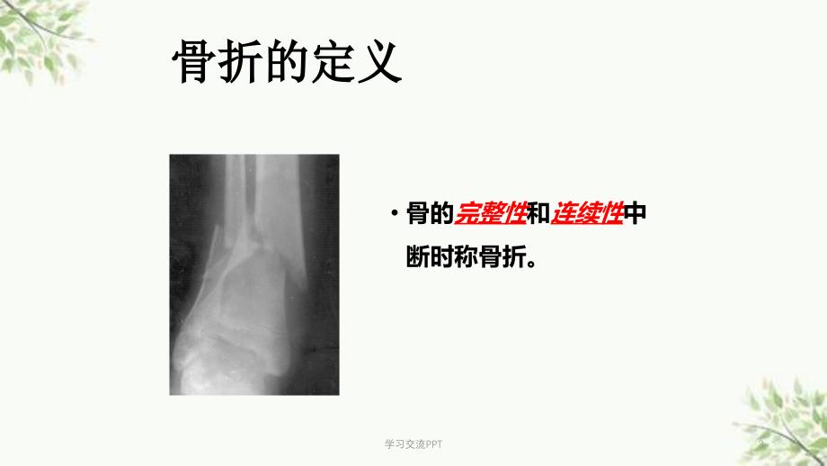 骨科骨折概论医学课件_第3页